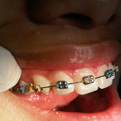 Profile Picture of Dentisia (@HelsingJoe) on Twitter