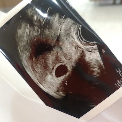 Profile Picture of Sudteerak (@Sudteer47481579) on Twitter