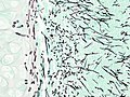 Profile Picture of Aspergillosis - Wikipediaon Wikipedia