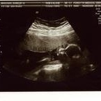 Profile Picture of Shirley Whicker (@104615190) on Myspace