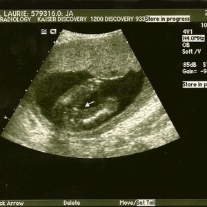 Profile Picture of Laurie Hill (@mummmblebee) on Myspace