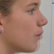 Profile Picture of Mewing Progress Tracker (@MewingProgressTracker) on Youtube