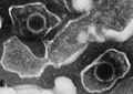 Profile Picture of Epstein–Barr virus - Wikipediaon Wikipedia