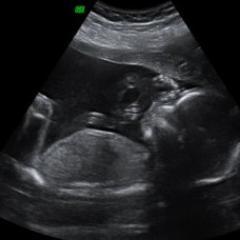 Profile Picture of Bronson Martin (@kapenamartin) on Twitter