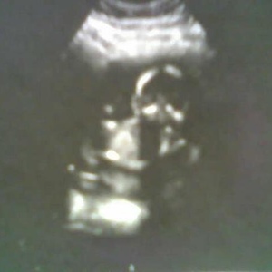 Profile Picture of Amanda Mc Guinness (@324479338) on Myspace