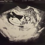 Profile Picture of Cy Leonardo Benitez (@cymanningbenitez) on Instagram
