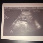 Profile Picture of Aiden Lucas Donald (@aiden_lucas_donald) on Instagram