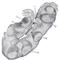 Profile Picture of Tonsillar cryptson Wikipedia