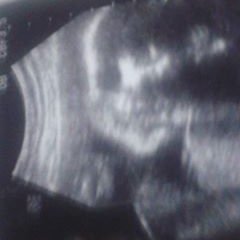 Profile Picture of Montserrath Onofre Andrade (@monse.onofreandrade) on Myspace