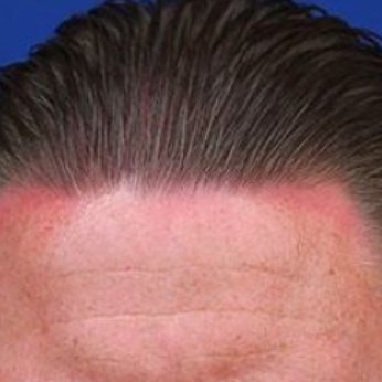 Profile Picture of Ben Mcadoo (@ben_mcadoo) on Twitter