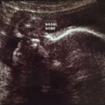 Profile Picture of Robyn Daniella Burhan (@robyn_daniella) on Instagram