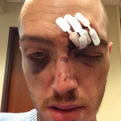 Profile Picture of Fergus Grant (@Fergusgrant9) on Twitter