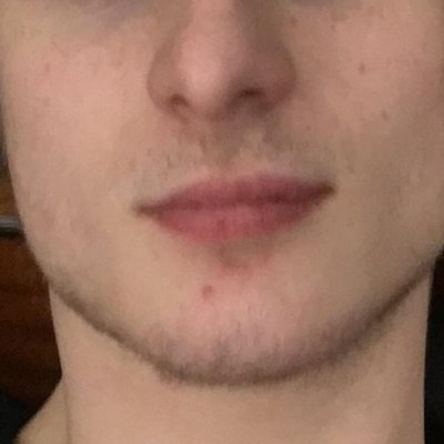 Profile Picture of Belter Ched (@JohnChavasse) on Twitter