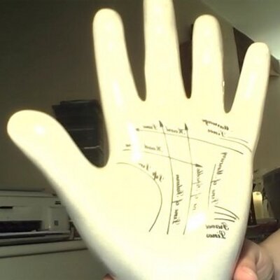Profile Picture of Jeremy Field (@Handsurgeon1) on Twitter