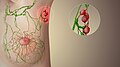 Profile Picture of Sentinel lymph node - Wikipedia, the free encyclopediaon Wikipedia