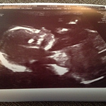 Profile Picture of Joel And Lucy Davies (@baby_davies2015) on Flickr