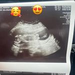 Profile Picture of Nery Ramírez (@nery.ramirez.946517) on Instagram