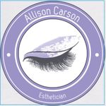 Profile Picture of Allison Carson (@allycatclaws) on Instagram