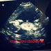 Profile Picture of Greg Giddings (@greg.giddings.589) on Facebook