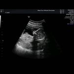 Profile Picture of Tracey Craven (@tracey.craven.336) on Instagram