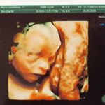 Profile Picture of Juan Carlos Quinteros (@juanca.quinteros) on Instagram