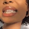 Profile Picture of chase roy (@@chase.roy) on Tiktok