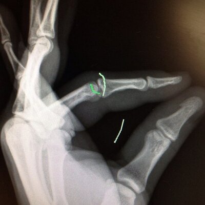 Jonathan Cournoyer - Twitter Profile Picture of Jonathan Cournoyer (@joncounoyer) on Twitter