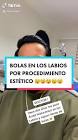 Profile Picture of   Bolas de “Ácido... (@drramses) on Tiktok