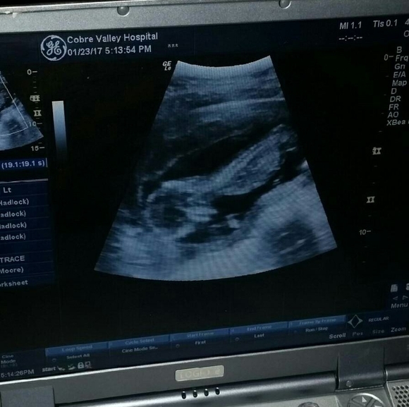 Profile Picture of Crystal Knapp (@crystal3162) on Poshmark