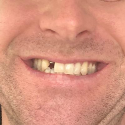 Profile Picture of Patrick Colbert (@_patrickcolbert) on Twitter