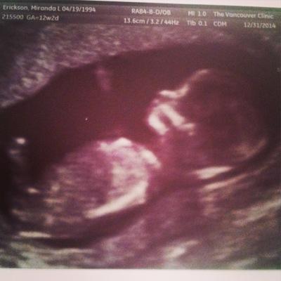 Profile Picture of Miranda Erickson (@dahtadah) on Twitter