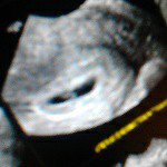 Profile Picture of Michaela Daniels (@teenmom11.14.15) on Instagram