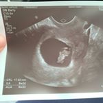 Profile Picture of Natalie Ralph (@nat_a_lee_r) on Instagram