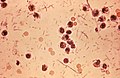 Profile Picture of Shigella - Wikipediaon Wikipedia