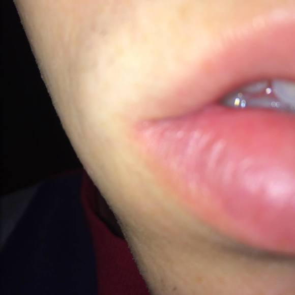 Profile Picture of Ross Rudolph (@roxxorudolph) on Poshmark