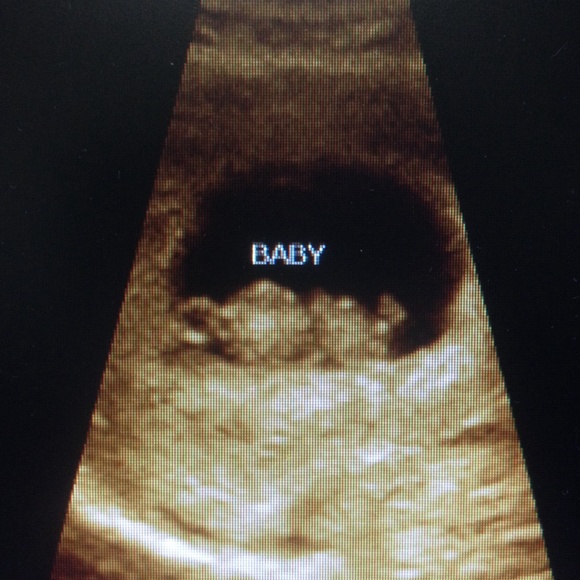 Profile Picture of Lindy Howell (@wyattsmomma16) on Poshmark