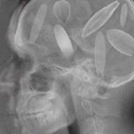 Profile Picture of Kirk Baker Surfboards (@kirkbakersurfboards) on Instagram