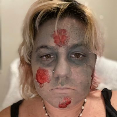 Profile Picture of Abby Normal 🧠 (@Tiny_Thompson) on Twitter