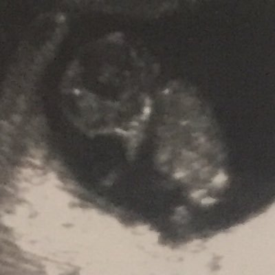 Profile Picture of Dwayne  (The Stone)Johnson (@DwayneJ58851795) on Twitter