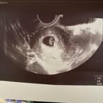 Profile Picture of Austin Keneson (@austin.keneson.7) on Facebook