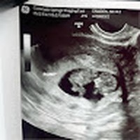 Profile Picture of Thomas Allison (@thomas-allison-70) on Quora