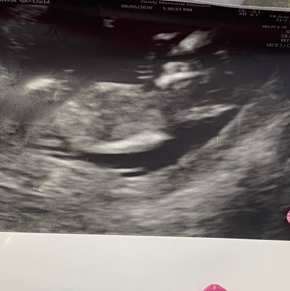 Profile Picture of Bianca Mahoney (@bianca9123) on Poshmark