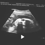 Profile Picture of Matteo Silva (@matteosilva020) on Instagram