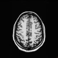 Profile Picture of Jerimiah Honer (@jerimiahvii) on Facebook