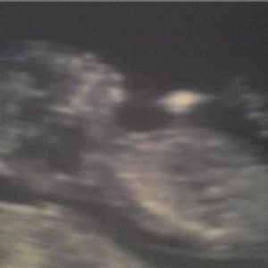 Profile Picture of Ben Nunes (@jamin660) on Myspace