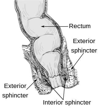 Profile Picture of Fecal incontinenceon Wikipedia