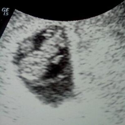 Profile Picture of Tayler Sadowski (@AlexandraTayler) on Twitter