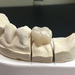 Profile Picture of Terry Golden (@golden_dental_lab) on Instagram