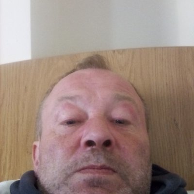 Profile Picture of MALCOLM GARRY DEWIS (@DewisGarry) on Twitter