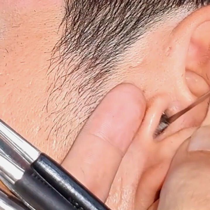 Profile Picture of Ear doctor (@eardoctor1) on Tiktok